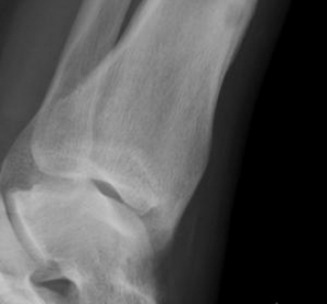 xray image of bone